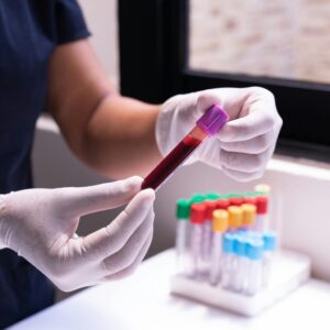 Técnico sosteniendo un tubo de ensayo con muestra de sangre en laboratorio